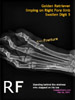 golden-retriever-stepped-upon-fracture-digit-5-right-fore-x-ray-toapayohvets-singapore.jpg