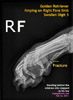 golden-retriever-stepped-upon-fracture-digit-5-right-fore-x-ray-toapayohvets-singapore.jpg