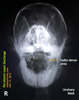 http://www.kongyuensing.com/cgi/20120214tn_sheltie-12years-persistent-purulent-yellow-green-nasal-discharge-x-ray-toapayohvets-singapore.jpg