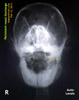 http://www.kongyuensing.com/cgi/20120215tn_sheltie-12years-persistent-purulent-yellow-green-nasal-discharge-x-ray-toapayohvets-singapore.jpg