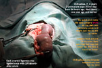 http://www.kongyuensing.com/cgi/20120230tn_chihuahua-6years-ultrasound-2fetuses-dead-caesarean-no-pups-toapayohvets-singapore.jpg