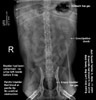 haematuria, old male Jack Russell Terrier X, urinary tract infection