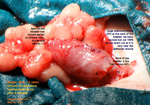 Adenocarcinoma tumour in bladder,urinary incontinence, dripping copious reddish brown blood, toapayohvets, singapore, beagle, male, 13 years