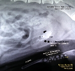 Lots of urinary sand inside the bladder. Toa Payoh Vets