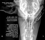 Poodle vomits food 2 hours after eating for past 3 years. Emaciated. toapayohvets, singapore 