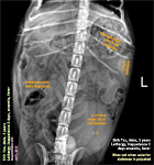 shih tzu, male, stomach, intestines, filled bone fragments, anaemia, fever, toapayohvets, singapore