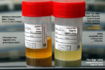 Two dogs' urine test analysis - ingestion poison, prostatitis, urinary tract infection, toapayohvets - singapore 
