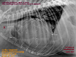 cardiac tamponade before pericardiocentesis, toapayohvets, singapore